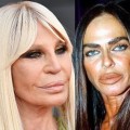 The Consequences of a Botched Plastic Surgery