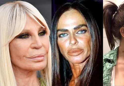 The Consequences of a Botched Plastic Surgery